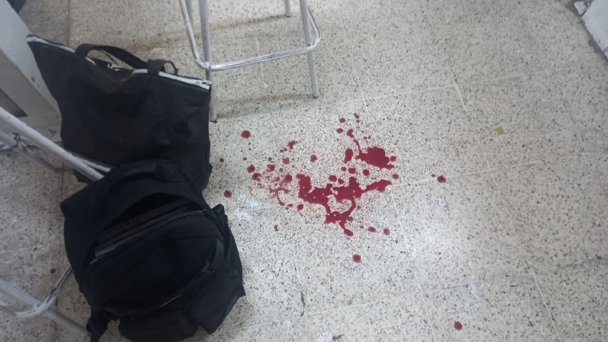 Niño mete arma a secundaria de Iztapalapa cdmx y se dispara en la mano