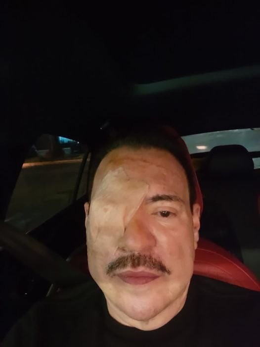 Operan de emergencia al cantante Julio Preciado. De pronto le empezó a sangrar u